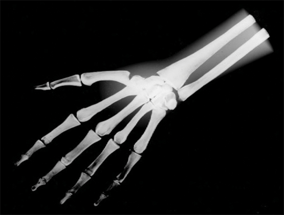 의료기기 X-Ray